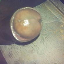 blackdick