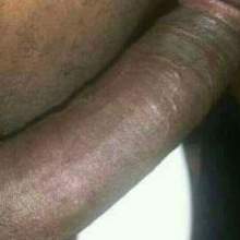 Hanglow