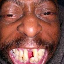 Bigtoenail23