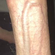 MRVEIN69