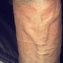 WillieRuiner