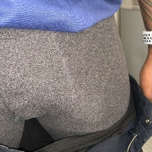 SlimfatD