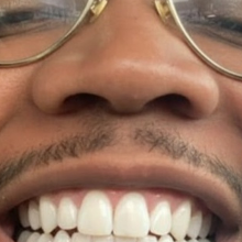 KeyMoney77